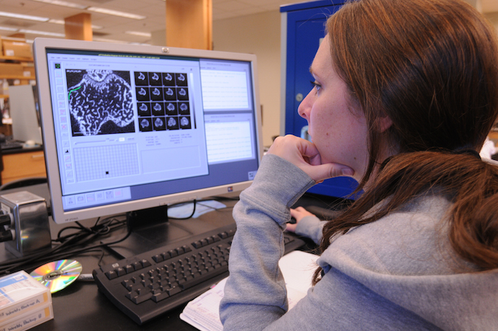 Reducing fracture risk in cancer patients: Clemson University graduate student Stephanie Riffle analyzes data from spongy bone collected for an NSBRI project studying space radiation-induced bone loss and determining which treatments can be used to reduce that loss and lower the risk of fractures. 